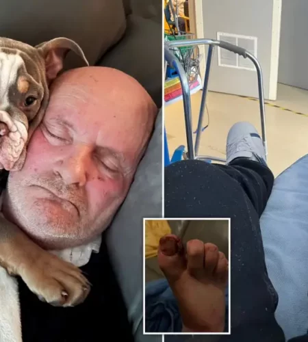 Man Says Pet Dog Chewed His Toe “To The Bone”, But It Saved his Life